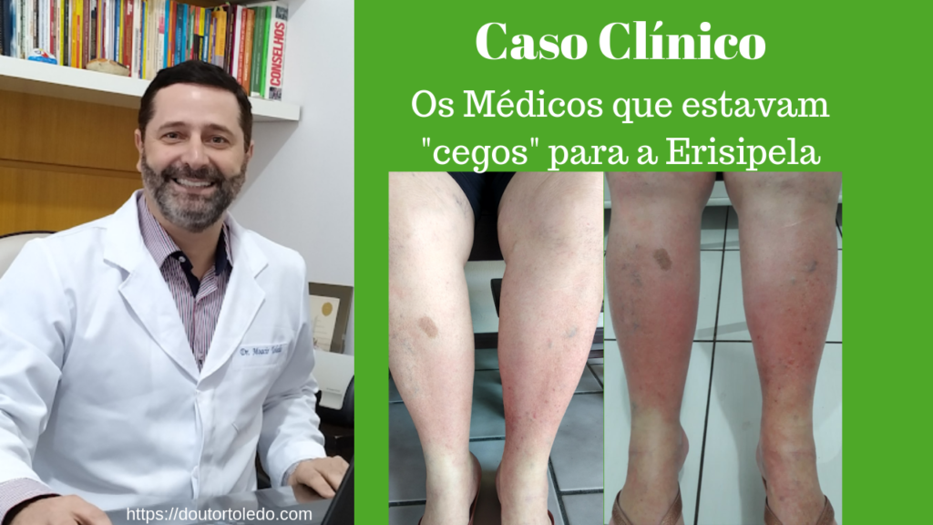 Caso Clínico Erisipela